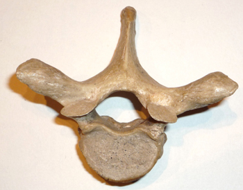 Vértebra dorsal